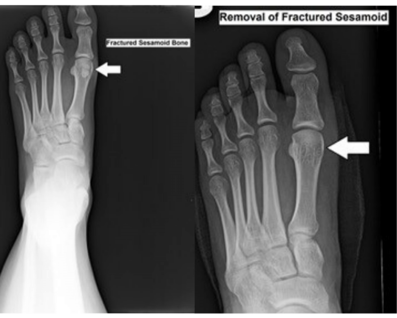 Before and After Surgery – Avada Classic